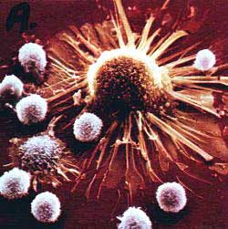 Menselijke T-cellen in de aanval op een kankercel. We kijken naar de beste kankerbestrijder. Het menselijke immuunsysteem.